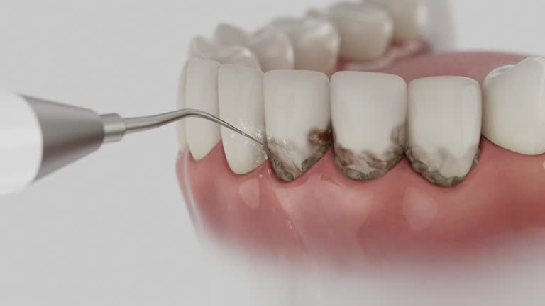 Reliable Dental Crowns And Bridges contractor in Marion County County, GA by Dentist Open Now